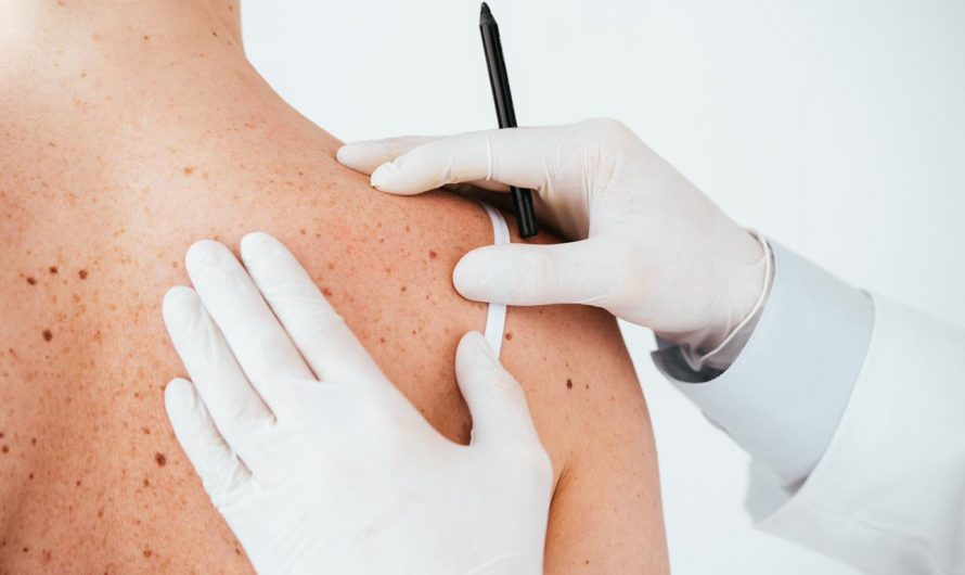 Врач-дерматовенеролог: «Все кожные заболевания сейчас помолодели»
